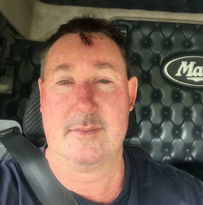Andrew Myers had to get six stitches in his forehead after a rock went through his windscreen and hit him in the head during an incident at 4am on Saturday, October 8. Hundreds of dollars of damage was done to Mr Myers' truck when at least three rocks hit it.