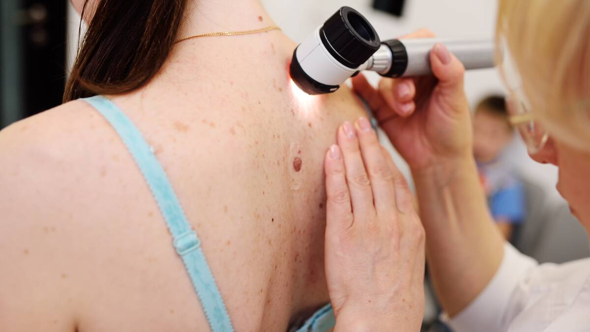 Aussies are urged to book in for their yearly skin check to catch any potential skin cancers early.